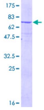 SDS-PAGE (EPHX1-3407H).jpg